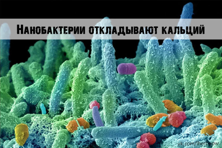 Подробнее о статье Вред антибиотиков почкам — появление камней от нанобактерий